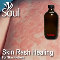 Essential Oil Skin Rash Healing - 500ml - Click Image to Close